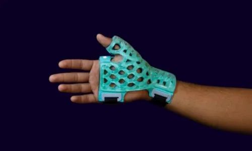 Blue/Green Flexi Oh Thumb Spica Immobilizer