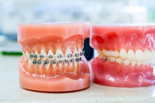 A Surprising Tool To Help You tooth bleaching in Dwarka