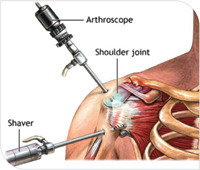 Orthopaedic Hospitals