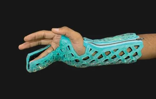 Fiberglass Blue/Green Flexi Oh Ulnar Gutter Immobilizer, Packaging Size: 1