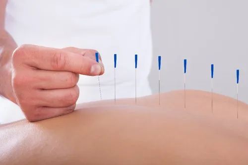 Male/female Acupuncture Therapy