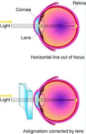 Toric Lens