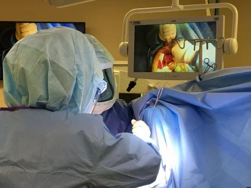 Surgical Video Recording Service