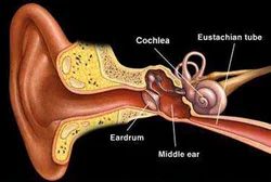 Hearing Implants