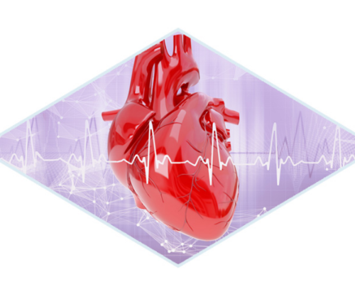 Cardiology Treatment