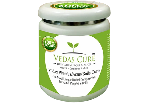 Vedas Pimples Acne Cure Cream