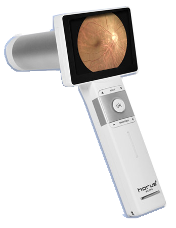 Horus DEC200 Handheld Digital Eye Fundus Camera