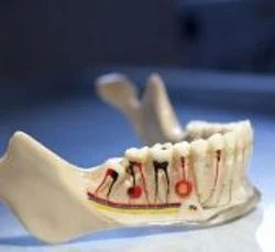 Endodontic Treatment : Root Canal
